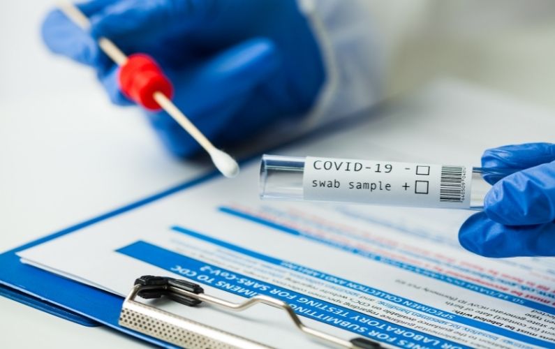 Covid-19 PCR test