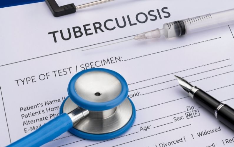 tuberculosis prevention